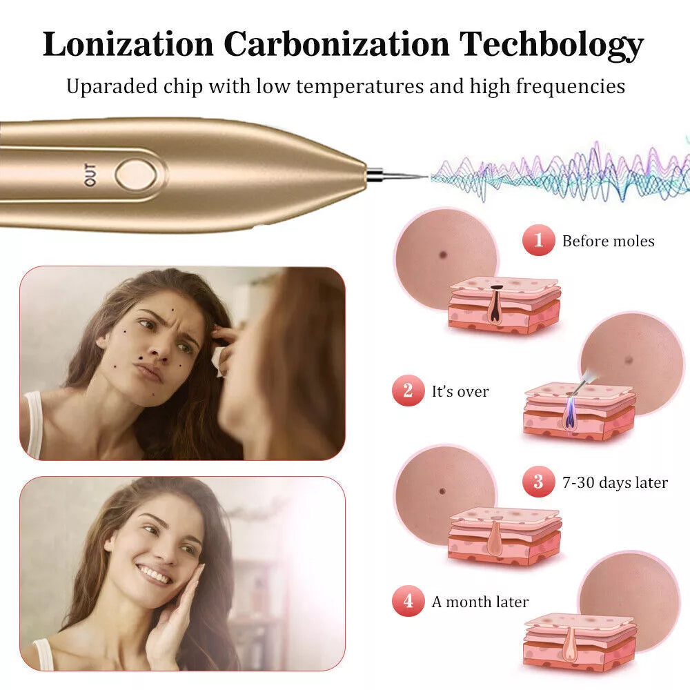 LCD Laser Pen Skin Tag Freckle Wart Mole Remove Pen Dark Spot Tattoo Removal US