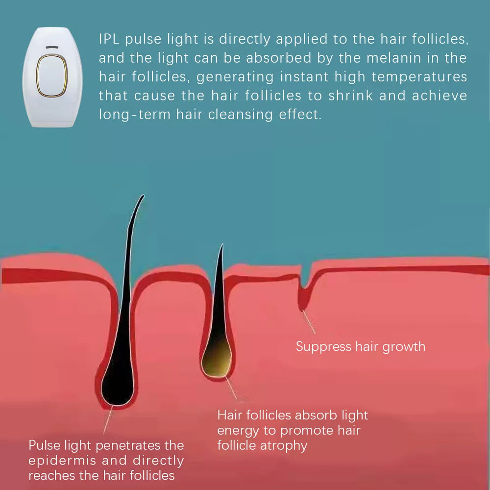 IPL Hair Removal Laser Permanent Body epilator Painless Device 990,000 Flashes