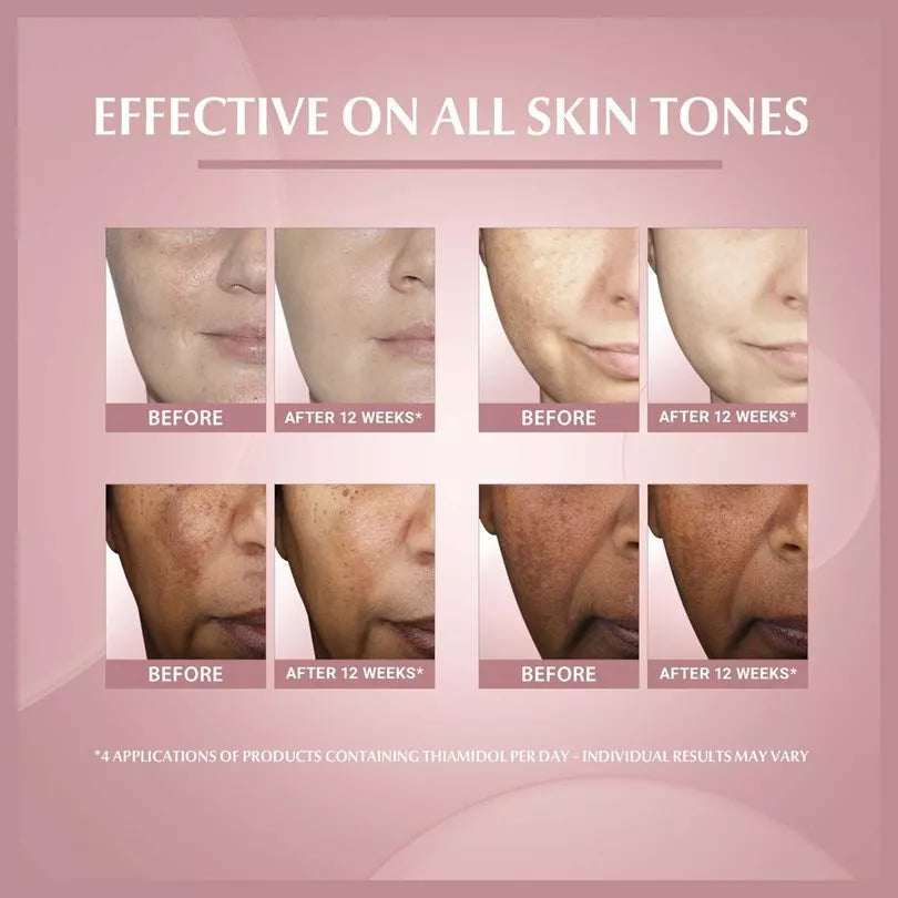 EUCERIN Anti Pigment Skin Perfecting Serum