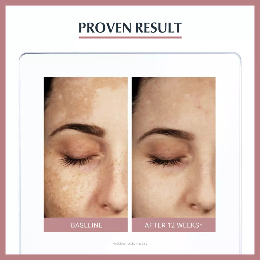 EUCERIN Anti Pigment Skin Perfecting Serum