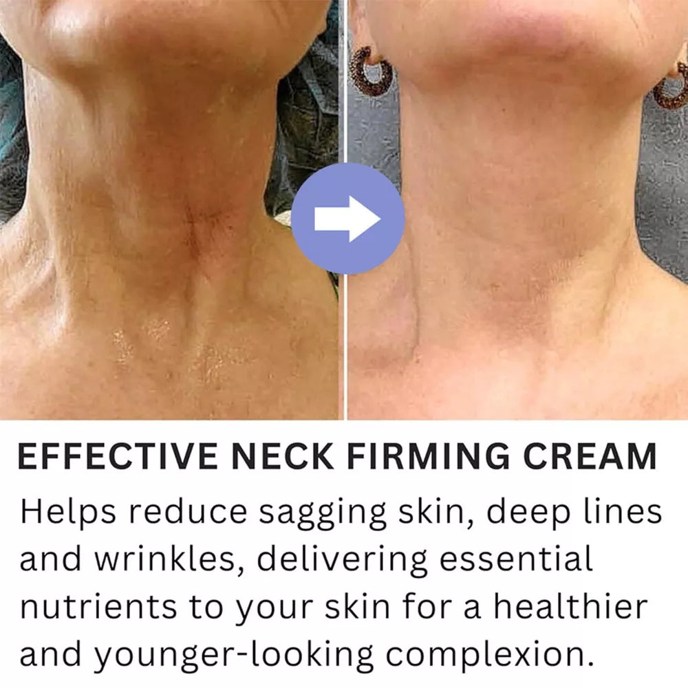 Neck Cream - Tighten & Lift Firming Neck Cream for Crepey Skin 2024 Must Have!