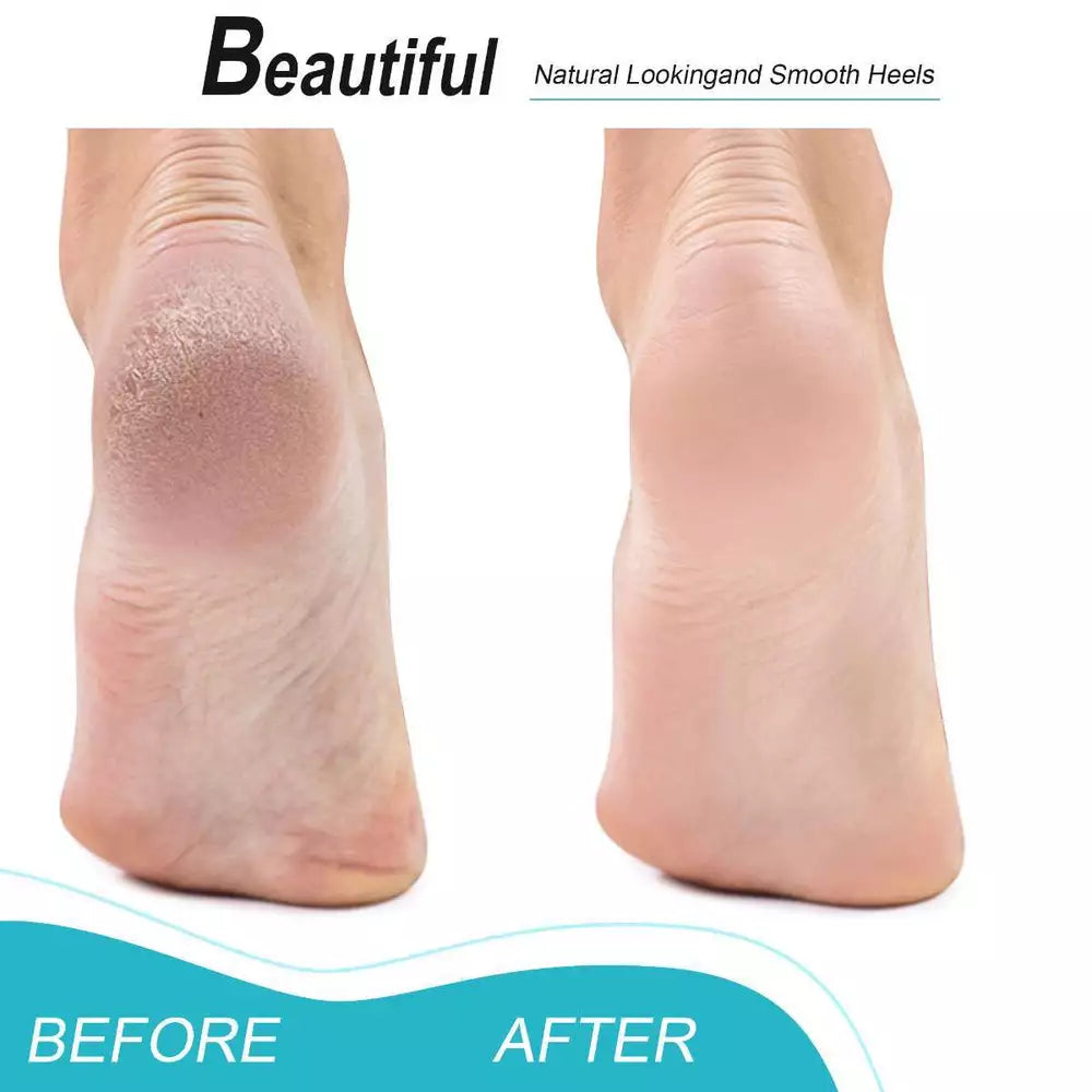 8 PACK Maryton Foot Pumice Stone for Feet Hard Skin Callus Remover and Scrubber