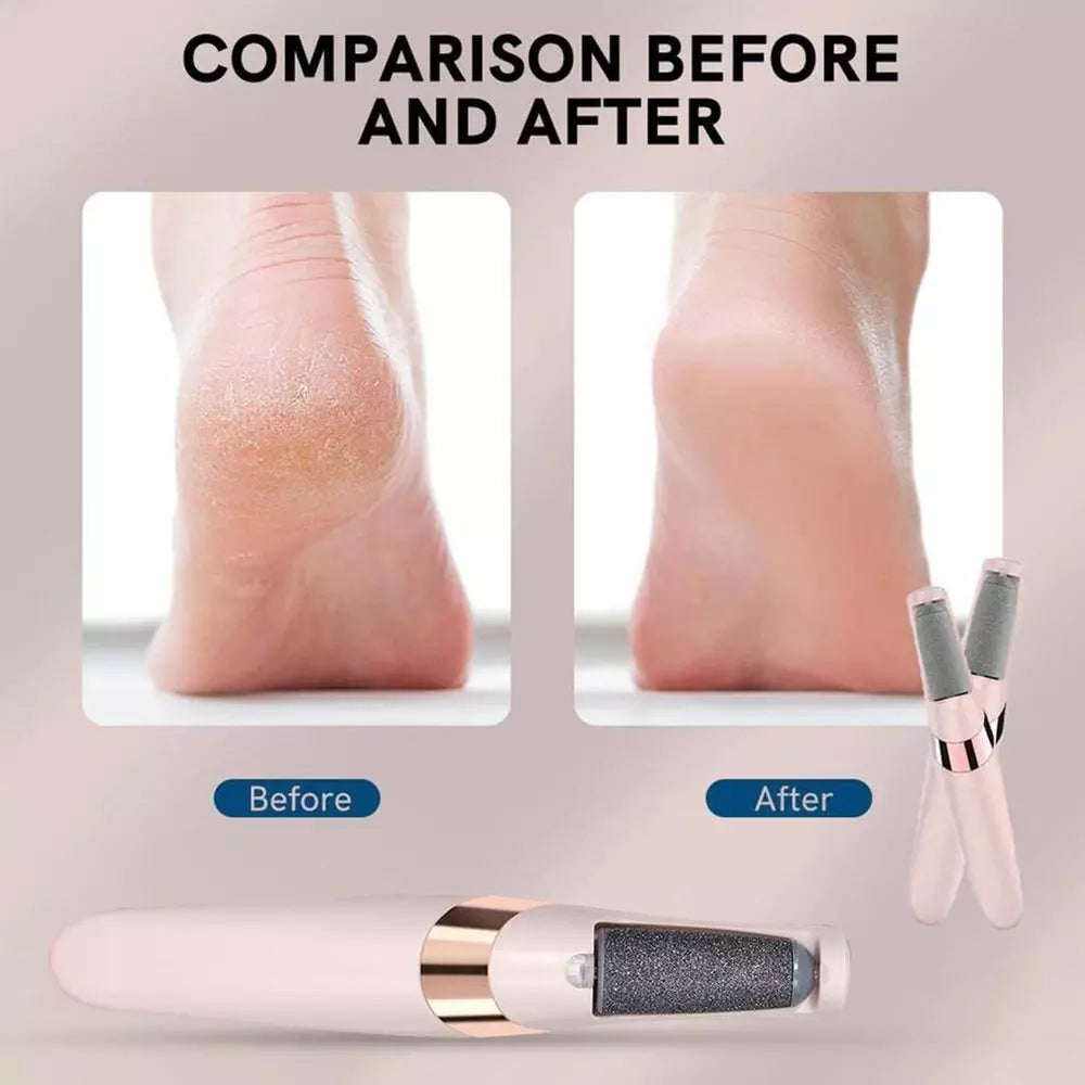 Finishing Touch Flawless Pedi Electronic Pedicure Tool - Rechargeable